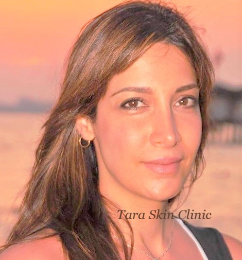 tara skin clinic skin health specialist newmarket